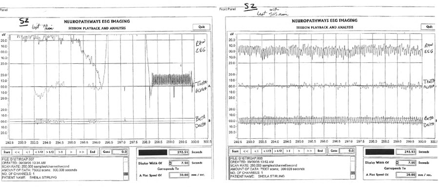 EEG-Imaging